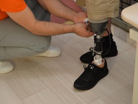 25 qazi yüksək texnologiyalı protezlə təmin edildi