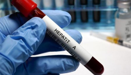 Səhiyyə Nazirliyi Hepatit A infeksiyasına yoluxma halları ilə bağlı məlumat yayıb