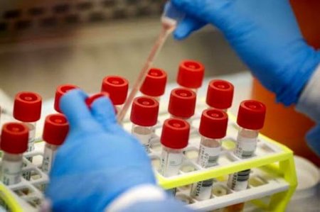 Türkiyəli cütlük koronavirusu üç dəqiqəyə müəyyənləşdirən test ixtira etdi - FOTO
