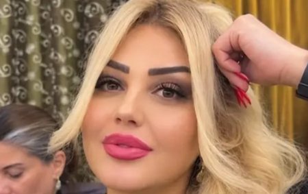 Bakıda dişini çəkdirən qadın vəfat etdi